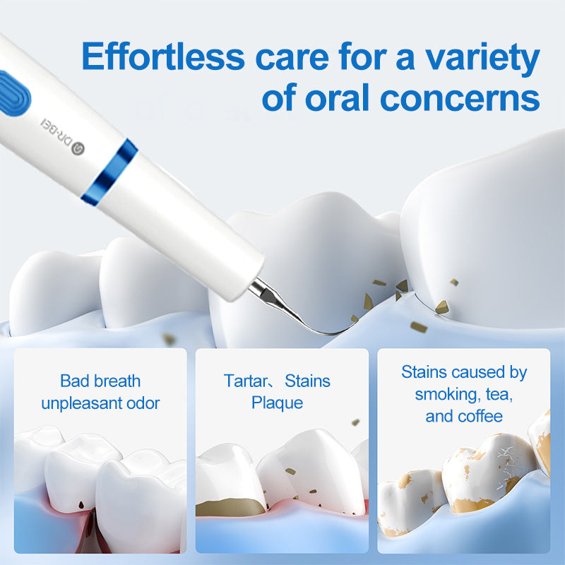 Best-selling high-quality ultrasonic dental cleaner