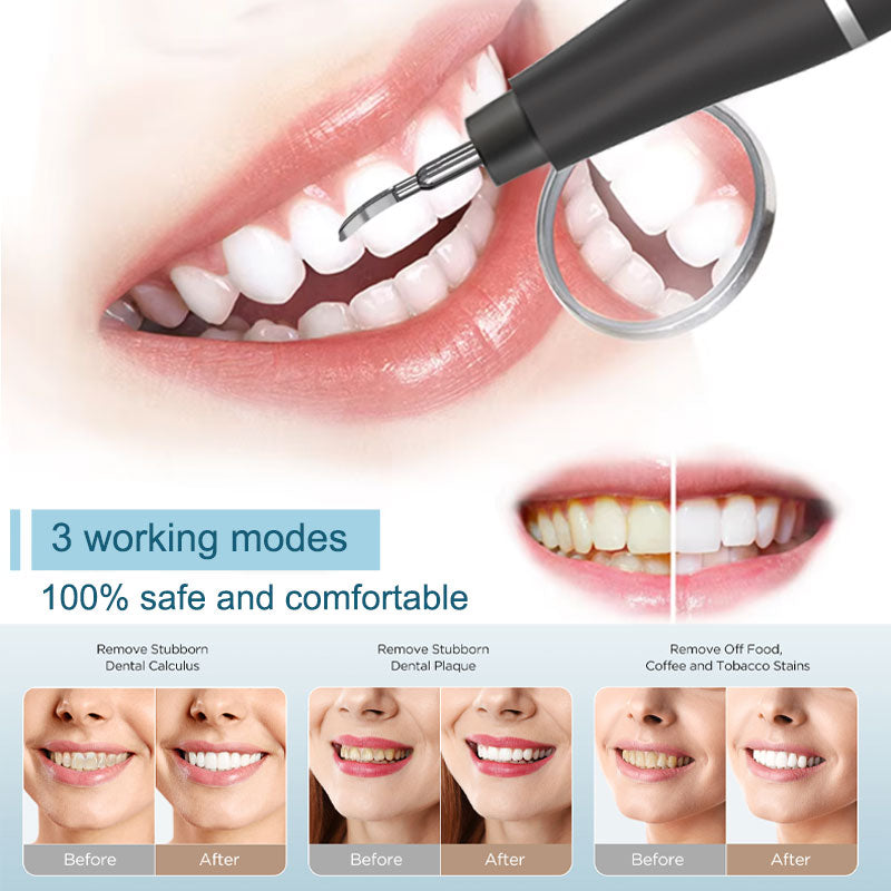 WiFi Visual Ultrasonic teeth cleaner 3 Adjustable Working Modes Rechargeable Portable Tartar Plaque Calculus Remover With Replacement Tips Household Oral Inspection Cleaning Device